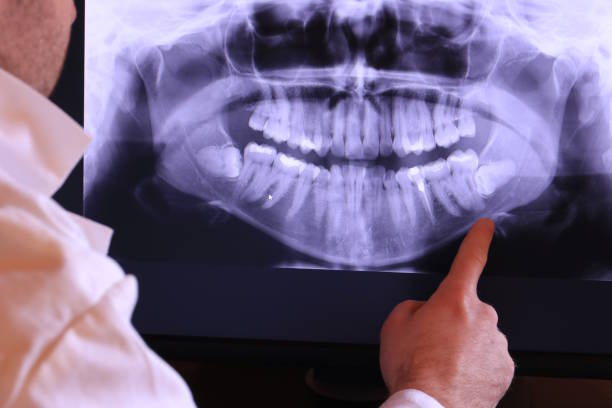 Best Emergency Dentist for Special Needs Patients in Cary, NC